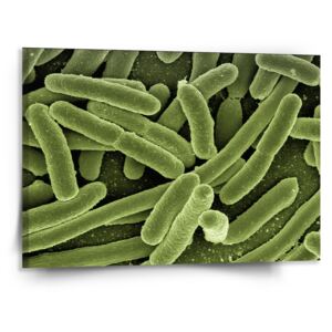 Obraz SABLO - Bakterie 110x110 cm