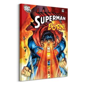 Obraz na plátně DC Comics Superman (Burn) 60x80 WDC99446