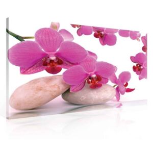 Postershop Obraz na plátně: Orchidej a kameny - 75x100 cm